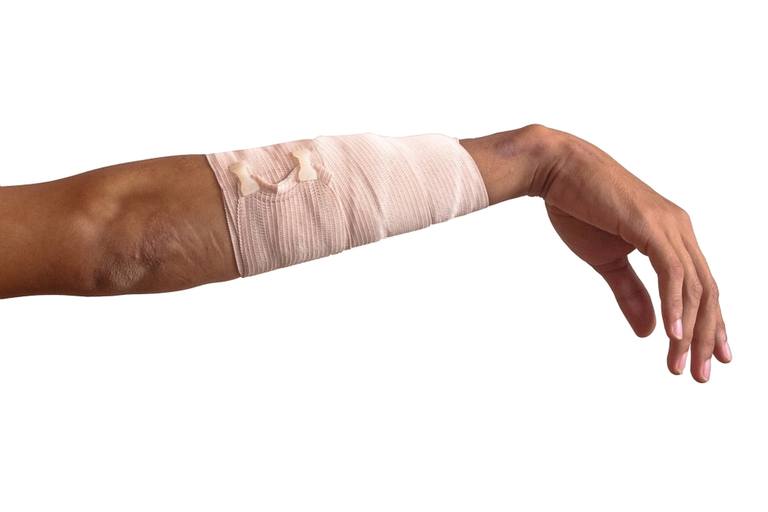 How to Treat Cuts, Scrapes, and Gouges in the Backcountry?